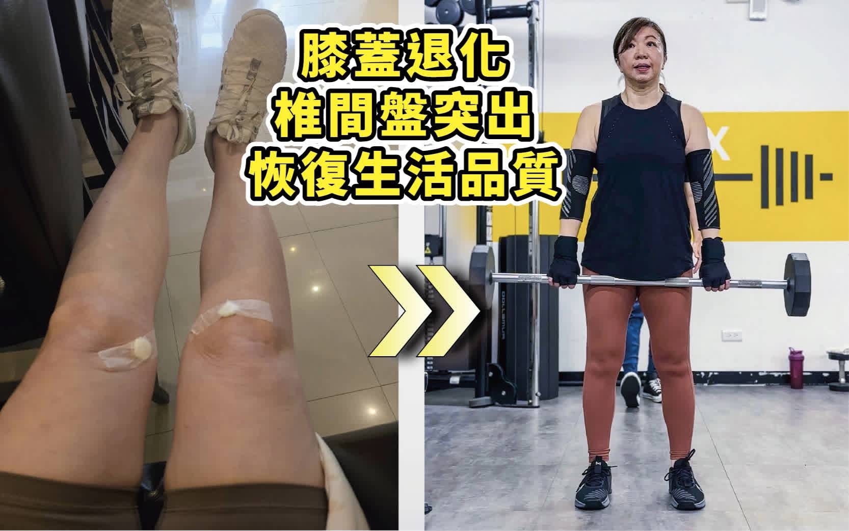 膝蓋退化、椎間盤突出，訓練恢復生活品質