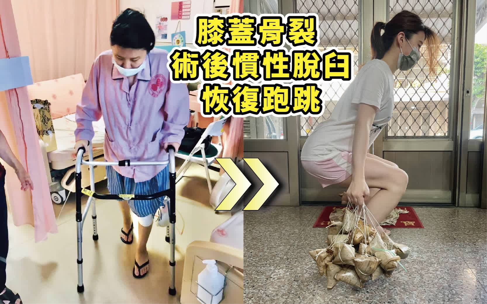 膝蓋骨裂，術後慣性脫臼，恢復跑跳